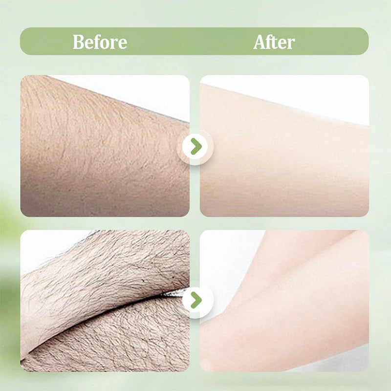 🌸 Jemná depilácia bez dráždenia a bolesti! 😍 Hladká pokožka už za pár minút