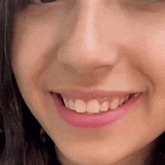 🦷SMILEFIT PRO – NASTAVITEĽNÁ SADA ZUBOV PRE DOKONALÝ ÚSMEV