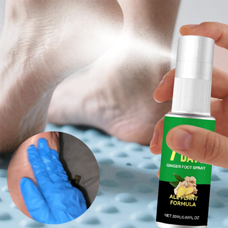🔥Kúp 1 získaj 1 zadarmo🔥Exfoliačný sprej na nohy so zázvorom – 7 dní