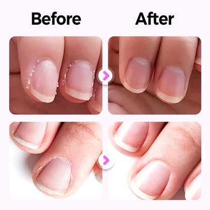 💖 Pero Na Nechty Nail Armor – 3-v-1 Regenerácia Pre Perfektné Nechty! 💅