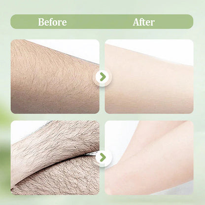 🌸 Jemná depilácia bez dráždenia a bolesti! 😍 Hladká pokožka už za pár minút