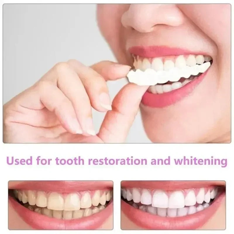 🦷SMILEFIT PRO – NASTAVITEĽNÁ SADA ZUBOV PRE DOKONALÝ ÚSMEV