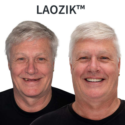 🔥【Gél na zuby zadarmo】Funkčné zubné protézy AdaptableFit