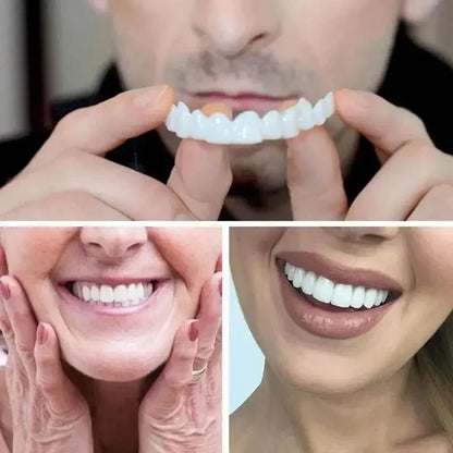 🦷SMILEFIT PRO – NASTAVITEĽNÁ SADA ZUBOV PRE DOKONALÝ ÚSMEV