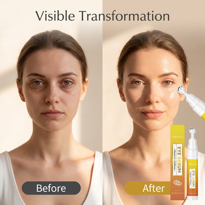 🌟 Očné sérum s vitamínom C – rozjasni a spevni pokožku okolo očí! ✨