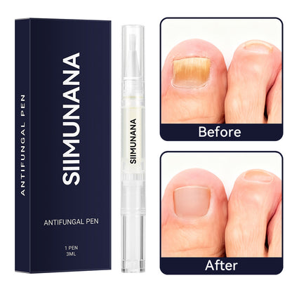💅 Žiadne lámavé nechty a slabé nechty? Krásne, silné a upravené nechty doma! ✨