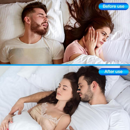 ✨Športové nosové pásiky plus lepiace nosové pásik—Lepšie Dýchanie Pre Spokojný Spánok! 🫁