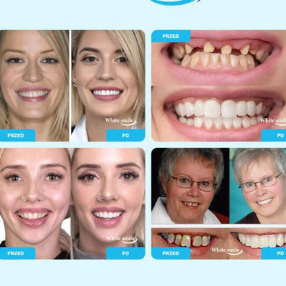 🦷SMILEFIT PRO – NASTAVITEĽNÁ SADA ZUBOV PRE DOKONALÝ ÚSMEV