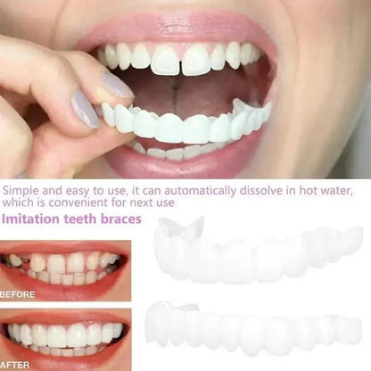 🦷SMILEFIT PRO – NASTAVITEĽNÁ SADA ZUBOV PRE DOKONALÝ ÚSMEV